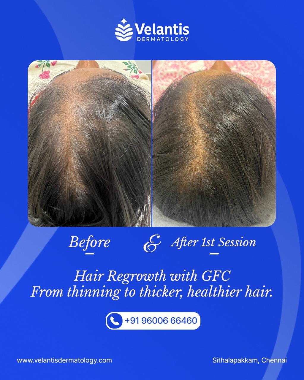 Velantis Dermatology Gallery